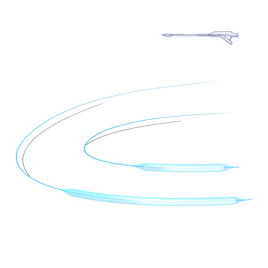 48002004X SABER PTA BALLOON .018"", OTW,2MM X 2CM, 150 CM"