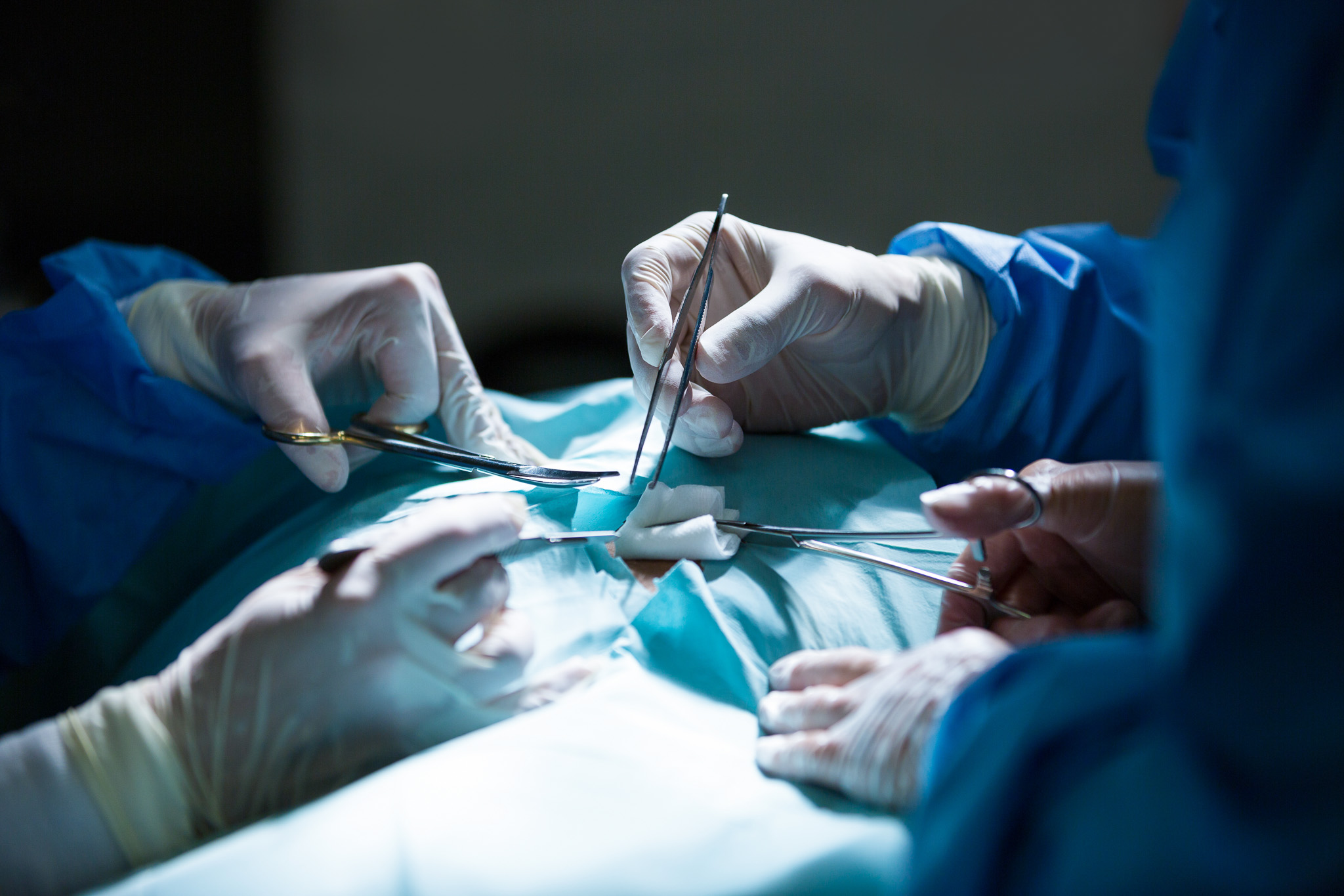 Surgeons performing operation in operation room INFINITI™ & SUPER TORQUE™ Plus - Catéteres de diagnóstico